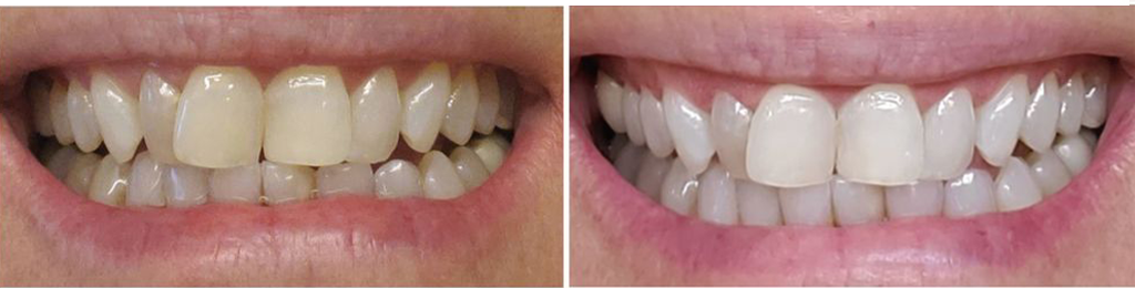 Estetska Stomatologija